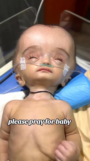 Please pray for baby #unfreezemyaccount #notcryafterdelivery #pleasepray #newborn #viralvideo | Spllitz