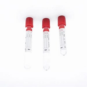 [Hot Item] Disposable Medical Supplies ESR Test 3.8% Sodium Citrate Vacuum Blood Collection Test Tube with CE