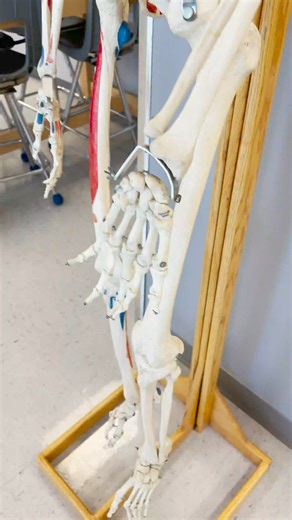 Dislocated Finger! #finger #dislocated #ouch #painrelief | Institute of Human Anatomy