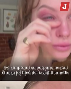 49K views · 52 reactions | Danielle Sheehan (32) je nakon pobjede na jednom izboru ljepote odlučila osvojeni iznos potrošiti na povećanje grudi nakon čega je počela gubiti kosu, dobila osip, a na kraju i privremeno oslijepila. | Jutarnji | Facebook