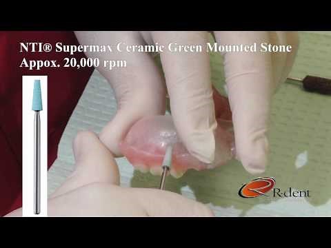 How to Properly Adjust Valplast Partials