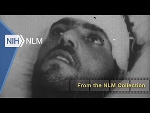 Rabies in Man [Silent] (US Army Medical Service, 1955)