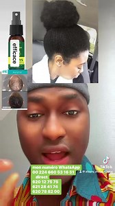 10K views · 144 reactions | mon numéro WhatsApp ‪00 224 660 53 16 51‬ direct 620 12 75 75 621 28 41 74 620 78 82 00 Prix 150.000 fran Guinée livraison gratuite | Super bazar akd | Facebook
