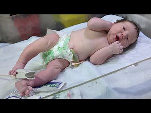 After Dilvery Newborn Head to Toe Assessment in NICU 👶🩺 | Complete Physical 💙 #assessment