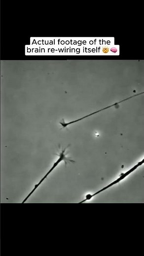 Actual footage of the brain re-wiring itself under a microscope 🤯🧠