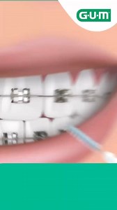 El Proxabrush de GUM®️ es ideal para limpiar eficazmente entre dientes y alrededor de brackets y puentes. Su diseño alcanza áreas difíciles, eliminando placa y restos de comida que otros cepillos no pueden. ¡El complemento perfecto para tu rutina oral! #Proxabrush #GUM #LimpiezaInterdental #SaludOral | Sunstar GUM | Facebook