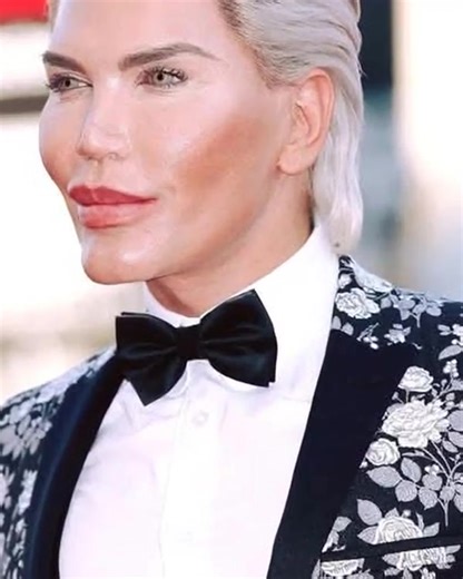 Woman transforms into real-life Ken and then Barbie after spending over $800,000 on 107 procedures – you better sit before you see how he looked before all surgeries... Check comments 👇🏻 | Every Day The Superheroes