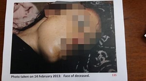 Oscar Pistorius Walks on Stumps at Hearing