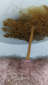 Desperate Diarrhea in Public Restroom at College