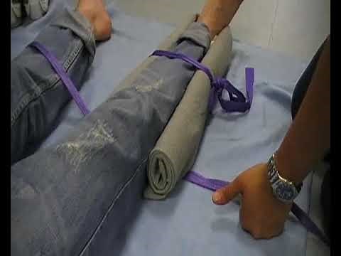 Fracture de la cheville