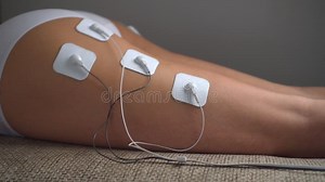 Electrical-stimulation TENs of the Girl`s Buttocks and Legs with Vibration Impulses from the Electrodes Stock Footage - Video of lady, back: 212705960