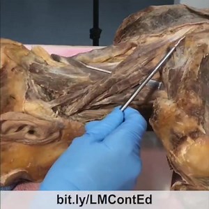 16 reactions | ️ LearnMuscles.com ️ The Levator Scapulae -...