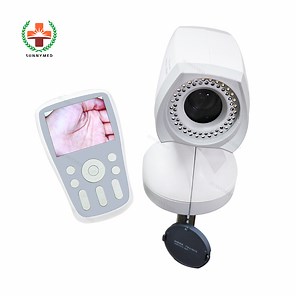[Hot Item] Sy-F005 Handy Digital Video Colposcopy Video Gynecologe for Vaginal Colposcopy