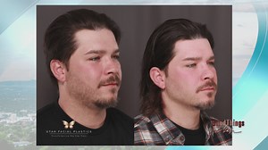 Comprehensive guide to weight loss: Programs and support at University of Utah Health