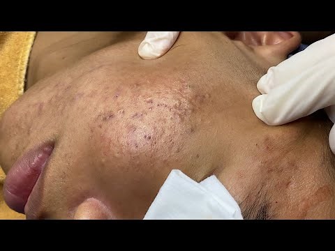 Relax Every Day With Sac Dep Spa #0410