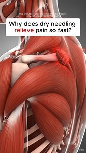 357K views · 1.8K reactions | Shoulder pain, tightness, stiffness, or...