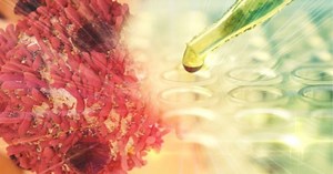 Race Oncology receives positive results from AML trial of Bisantrene