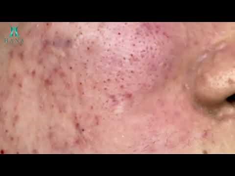 Satisfying Relaxation With Hana Spa #12