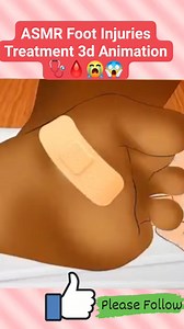 19K views · 68 reactions | ASMR Foot Injuries Treatment 3d Animation 喙喝|| #reels #satisfying #3danimation #video #animation #trending #treatment #cleaning | Akhilesh Yadav | Facebook