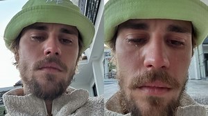 Justin Bieber: जस्टिन बीबर ने सोशल मीडिया पर साझा कीं रोती हुई तस्वीरें, फैंस हुए परेशान
