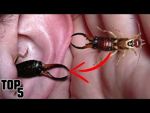Top 5 Gross Things Found In Human Ears