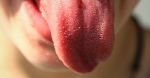 Cancer de la langue : peut-on en mourir ?