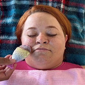 13K views · 192 reactions |  Homemade Botox with just 2 ingredients! | My Tips Book | Facebook