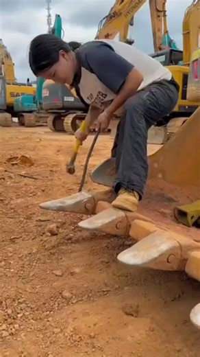 This girl's JCB bucket teeth had become very short and rounded | Rizwan Mewati
