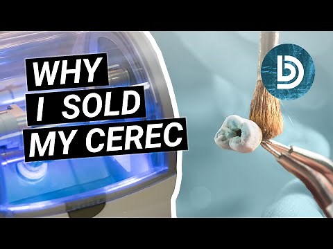 CEREC vs Dental Lab Crowns: Is Chairside Milling Worth It?
