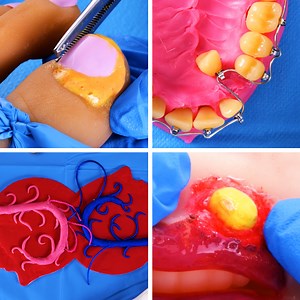 507K views · 434 reactions | Educational surgery imitations without limitations. How to remove objects that don't belong to your body?  | 5-Minute Crafts Teens | Facebook