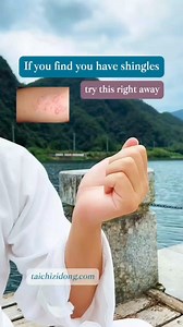 3.3K views · 50 reactions | Specific exercise Improve symptoms, daily fully- body exercise remove root causes.#taichi #tcm #healthylifestyle #exercise #meridian #chineseculture #shingles | Dr.Wudang | Facebook