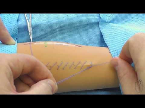 Continuous blanket suture making technique / Over-and-over continuos suture