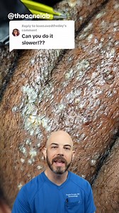 CRAZY extractions on skin with Acne Keloidalis Nuchae (credit: @theacnelab on TT) #satisfying #acne | Dr. Dustin Portela, Dermatologist