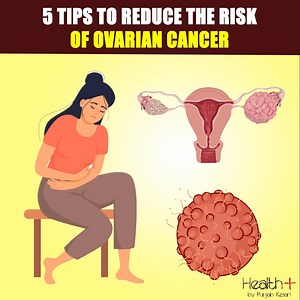 5 Tips to Reduce the Risk of Ovarian Cancer | Health