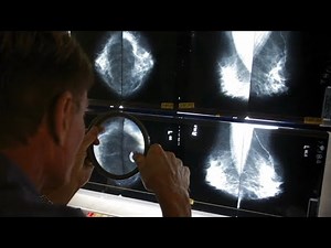 New mammogram guidelines for women recently vaccinated for COVID-19