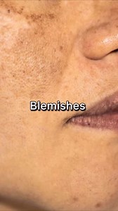 1.5K reactions · 32 shares | Experience skincare excellence with Dermatouch's Bright and Even Skin Tone Facewash!  Recommended by dermatologists, it's your daily essential for a refreshed complexion.  | Dermatouch | Facebook