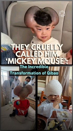 They Cruelly Called Him ‘Mickey Mouse’: The Incredible Transformation of Qibao | Cultura Colectiva
