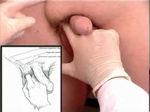 Penis Scientific Exam (Public Domain Video - Adults Only) - YouTube