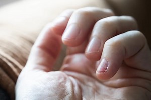 'I've stopped chewing my nails (well, I'm trying to). How do I heal the damage?'