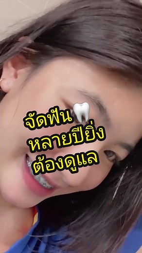 #จัดฟัน #ปัญหาคนจัดฟัน #MEDENT