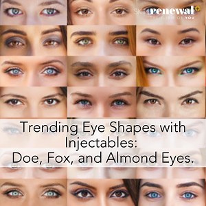 Trending Eye Shapes with Injectables: Doe, Fox, and Almond Eyes Enhance your natural features with the latest trends in eye shapes using injectables! The doe-eye look creates a wide-eyed, innocent appearance by lifting the brow and opening the eyes. For a sleek and sultry gaze, the fox eye trend uses strategic injections to elongate and lift the outer corners, achieving a feline allure. Almond eyes, known for their balanced and symmetrical shape, can be perfected with injectables that smooth and
