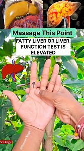 1.4M views · 8.6K reactions | Massage This Point FATTY LIVER OR LIVER...