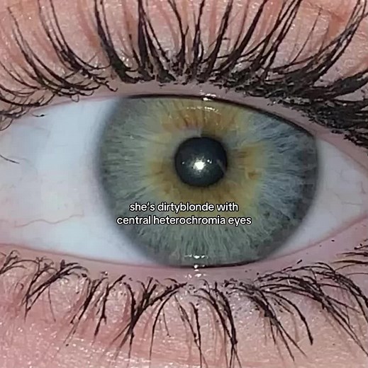 Stunning Dirty Blonde with Central Heterochromia