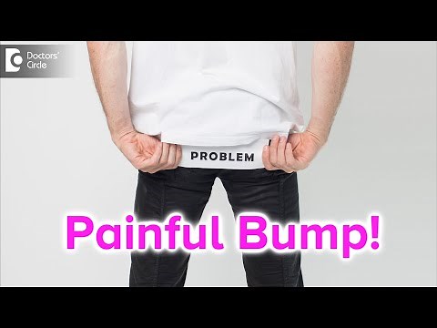 Painful bump on buttocks. Causes, Symptoms, & Treatment - Dr. Rajdeep Mysore | Doctors' Circle