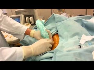 Renal Biopsy (I) - procedure and uses