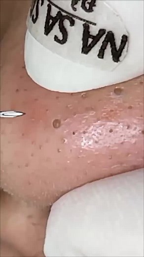 thebestblackhead on TikTok