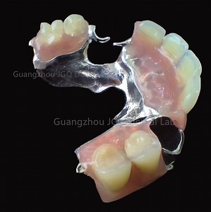 [Hot Item] Valplast Customized Flexible Dentures Competitive Price From Chinaese Dental Lab