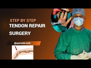 Extensor Tendon Repair - Step by Step Surgical Procedure Explained