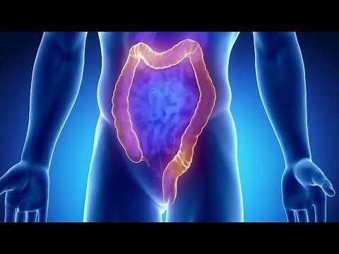 Epigenetics and their role in colon cancer