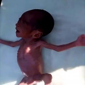 6 months baby ' 800grams' 👶 #Newborn #Baby #CuteBaby #Babies #CuteBabies | ရန်ကုန်သတင်းစုံ